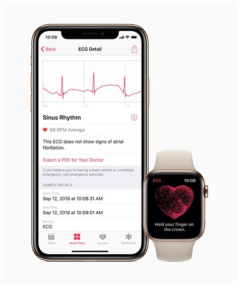 Take an ECG with the ECG app on Apple Watch.